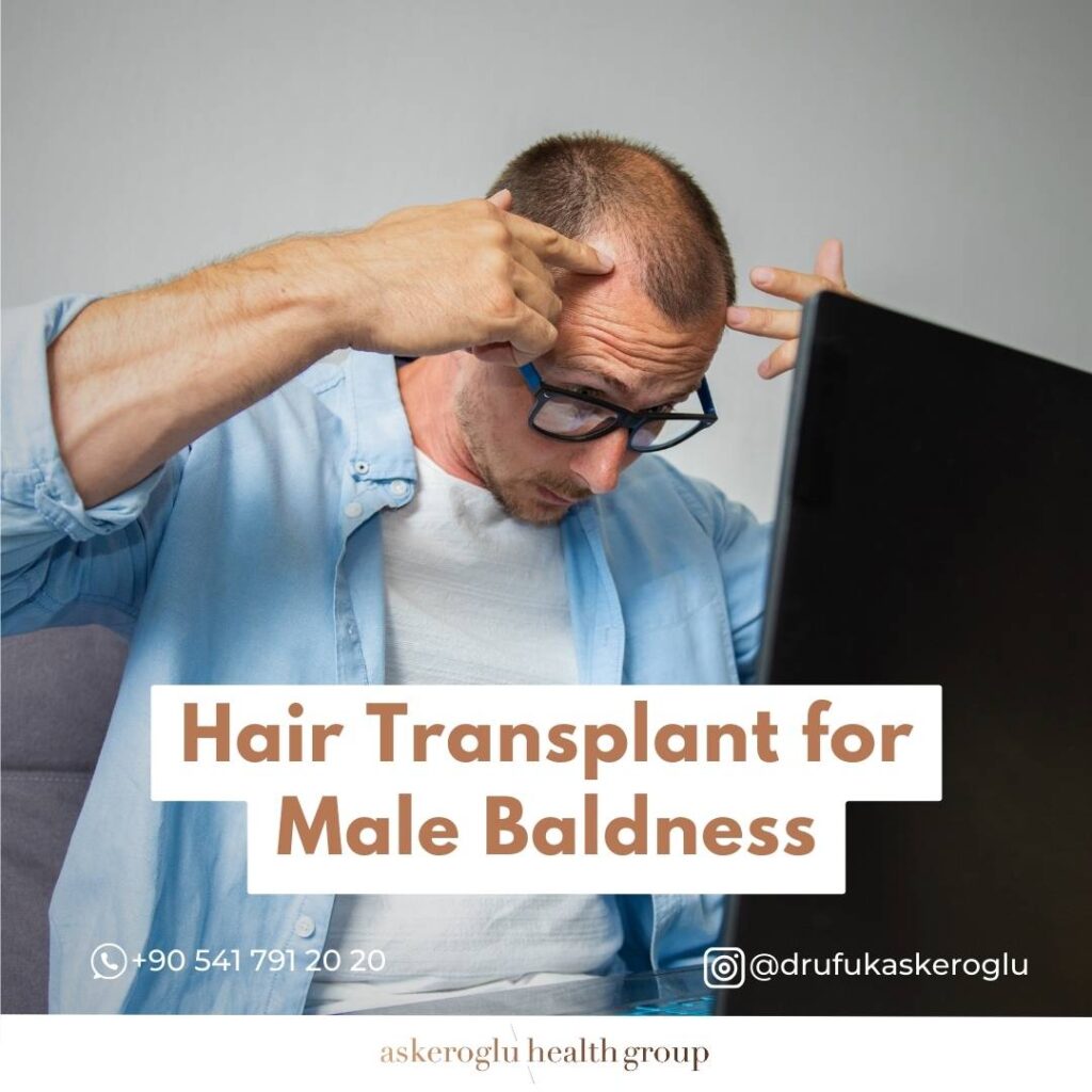 Hair Transplant Male Baldness