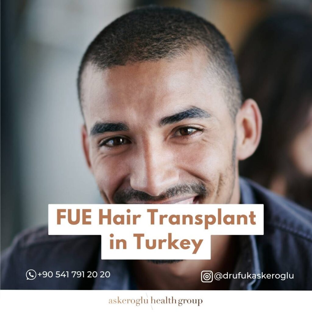 FUE Hair Transplant Turkey