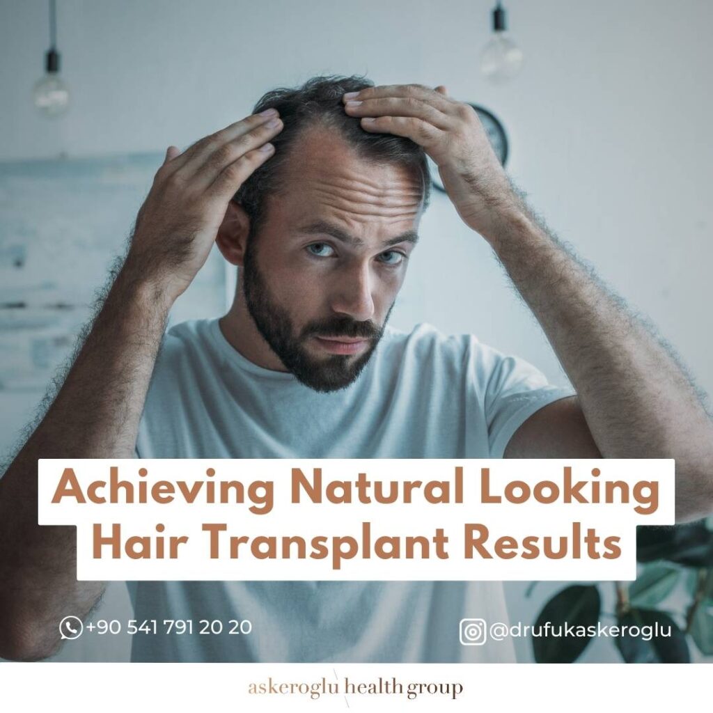 Natural Looking Hair Transplant
