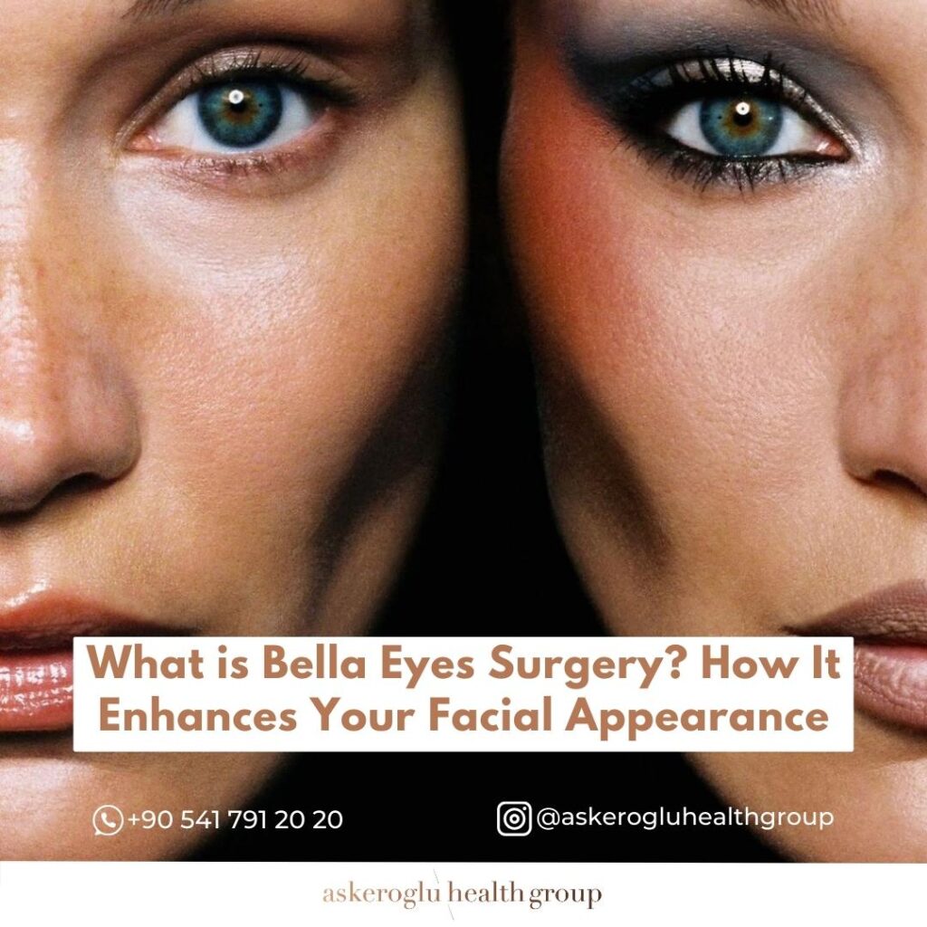 Endoscopic Bella Eyes Procedure