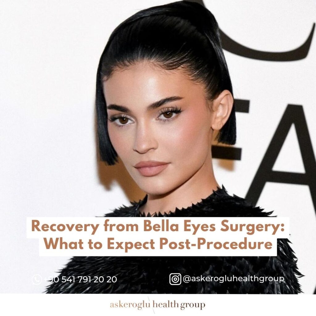 Recovery After Bella Eyes Surgery