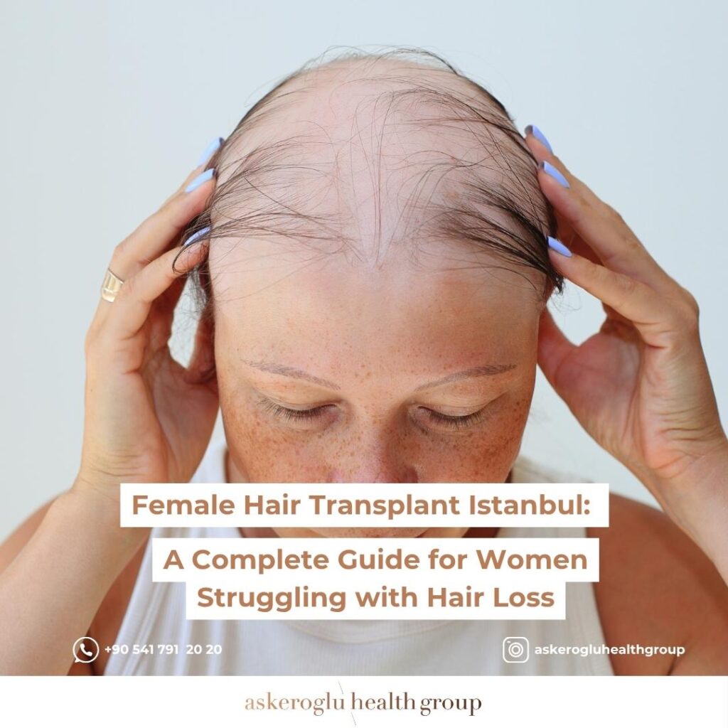 Female Hair Transplant Istanbul