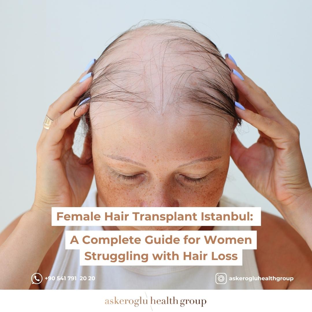 Female Hair Transplant Istanbul