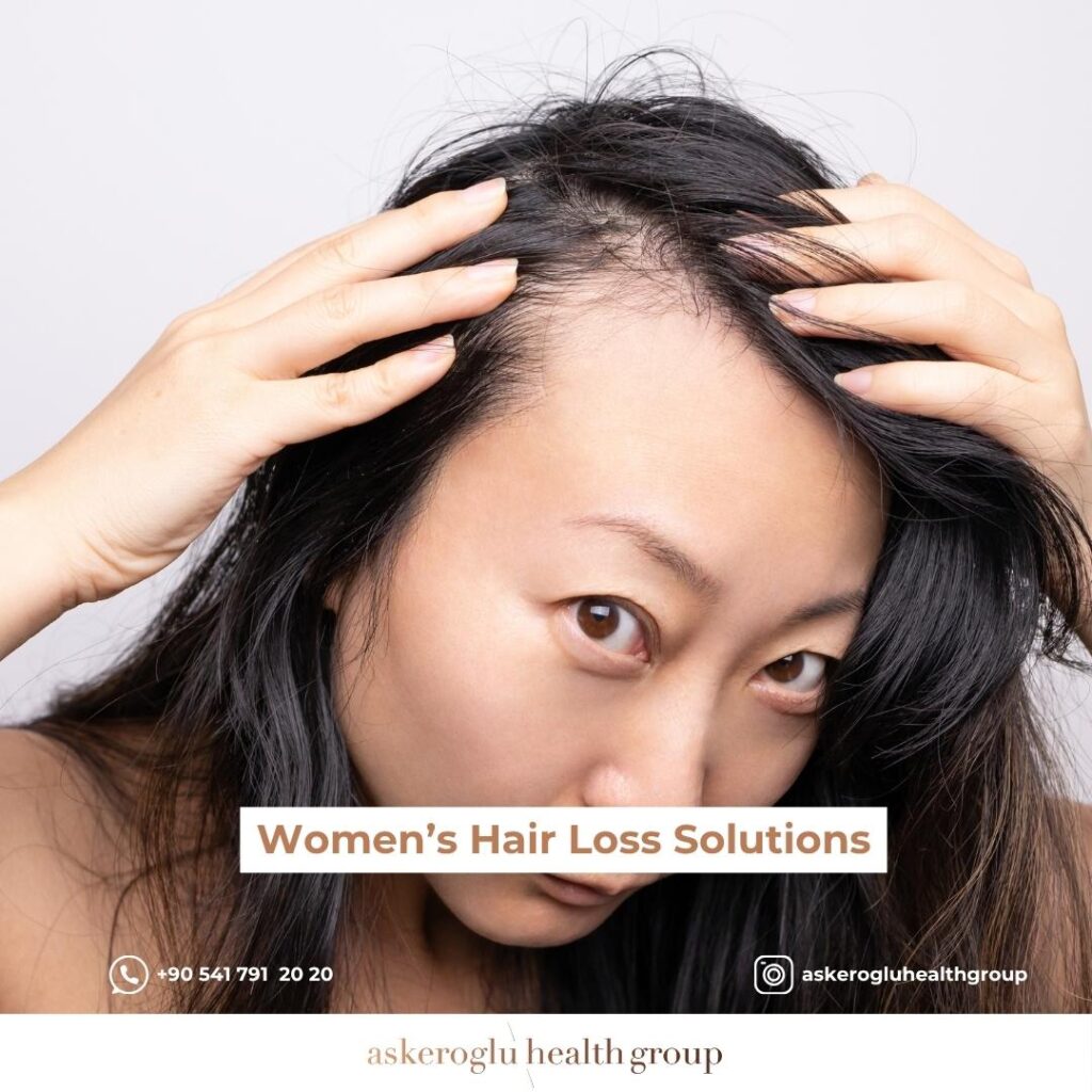 Women’s Hair Loss Solutions
