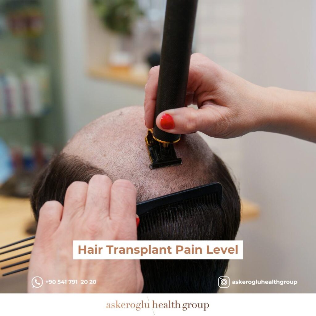 Hair Transplant Pain Level