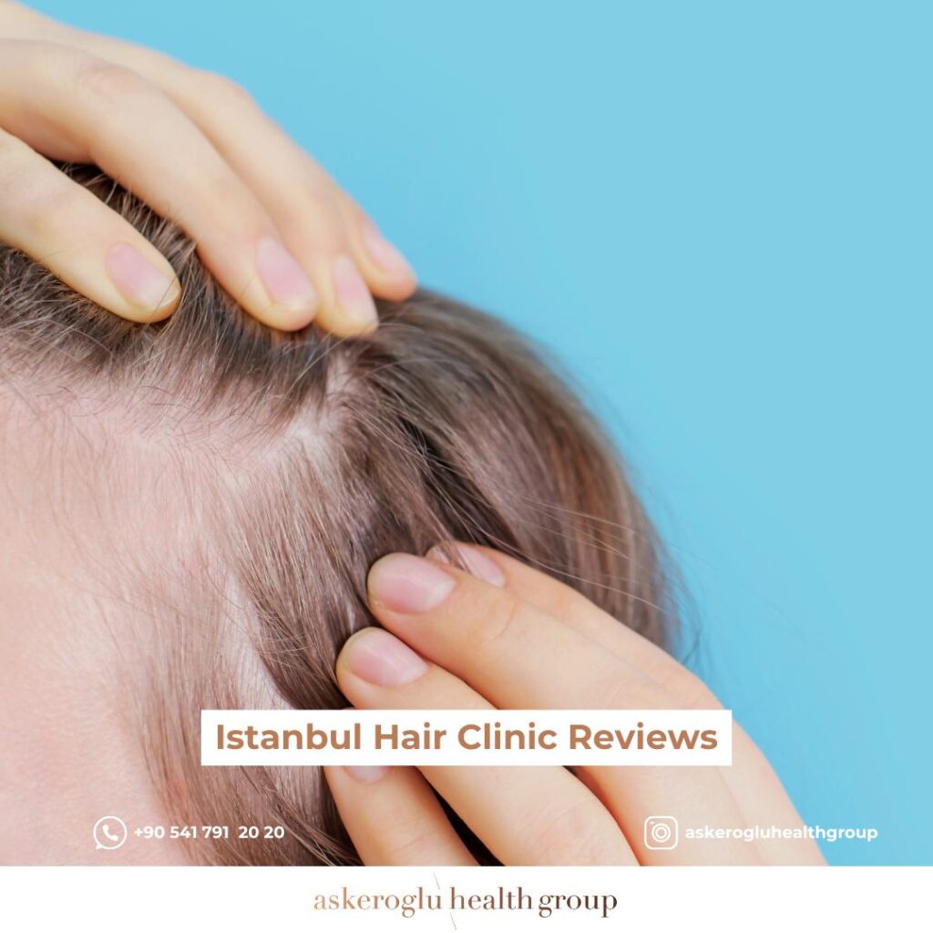 Istanbul Hair Clinic Reviews