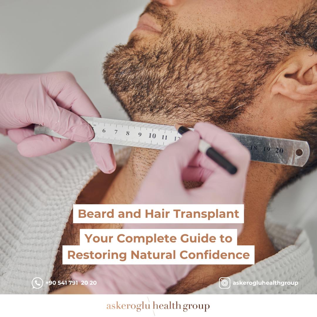 Beard and Hair Transplant