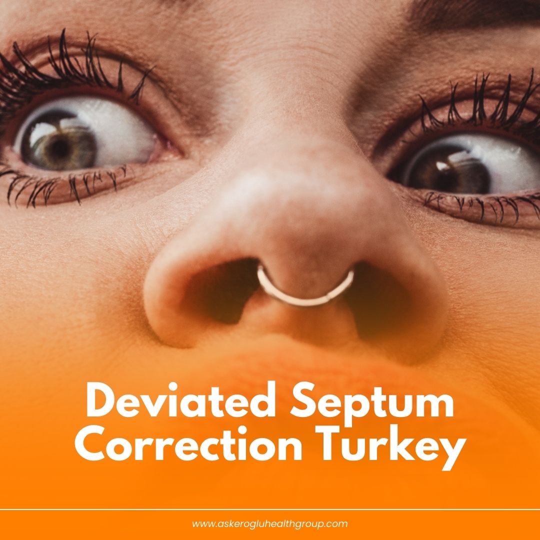 Deviated Septum Correction Turkey