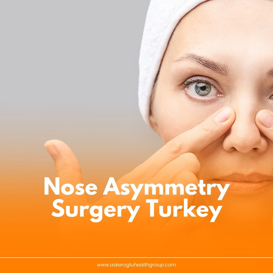 Nose Asymmetry Surgery Turkey