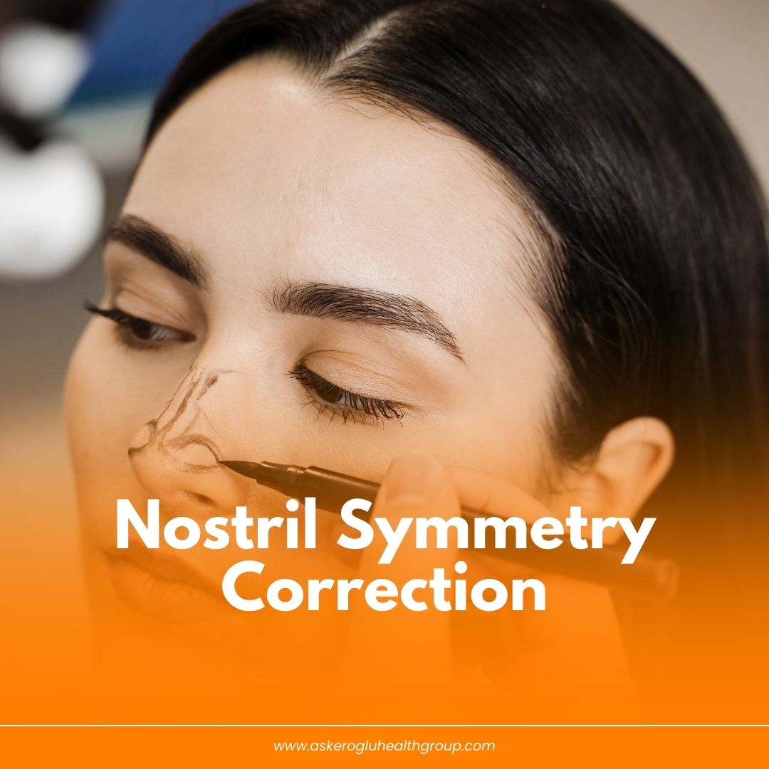 Nostril Symmetry Correction