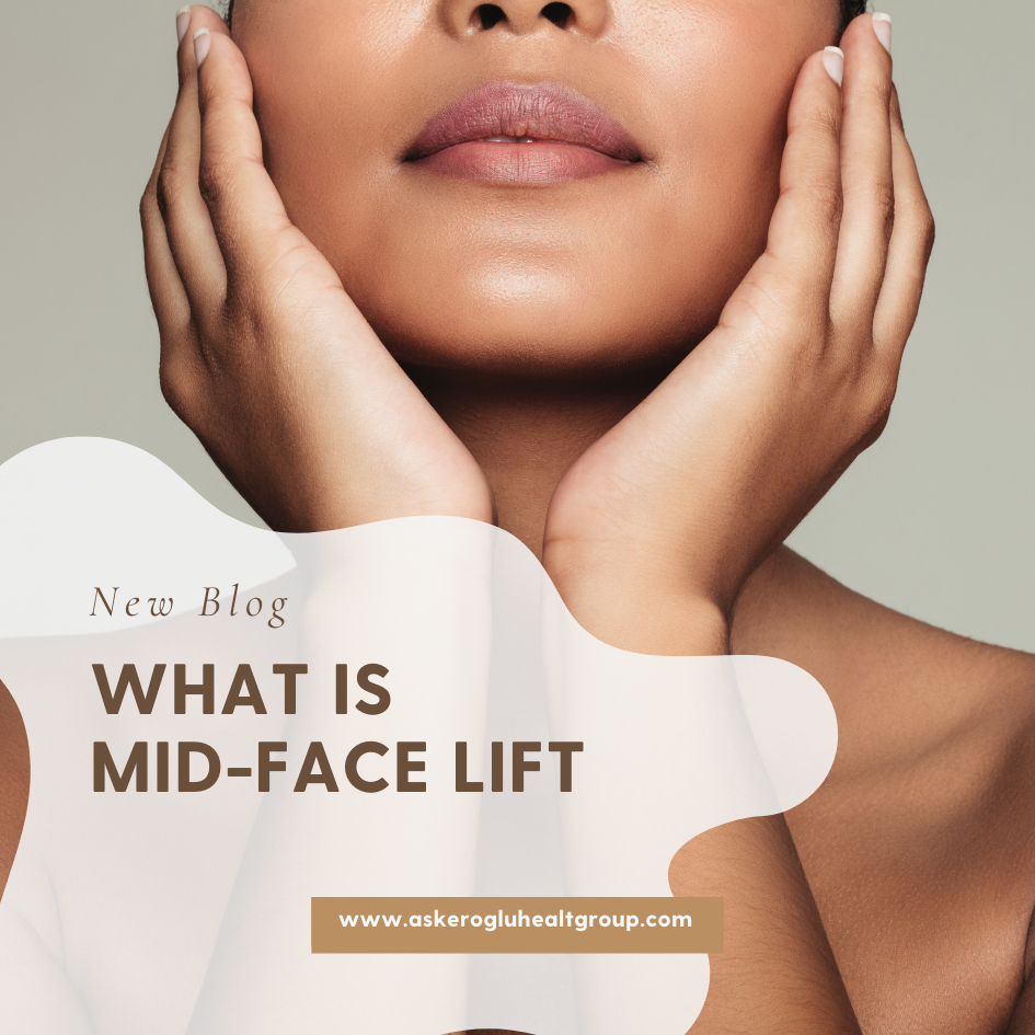 What Is Mid-Face Lift?