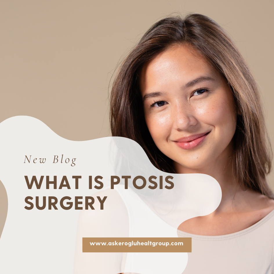 What Is Ptosis Surgery?