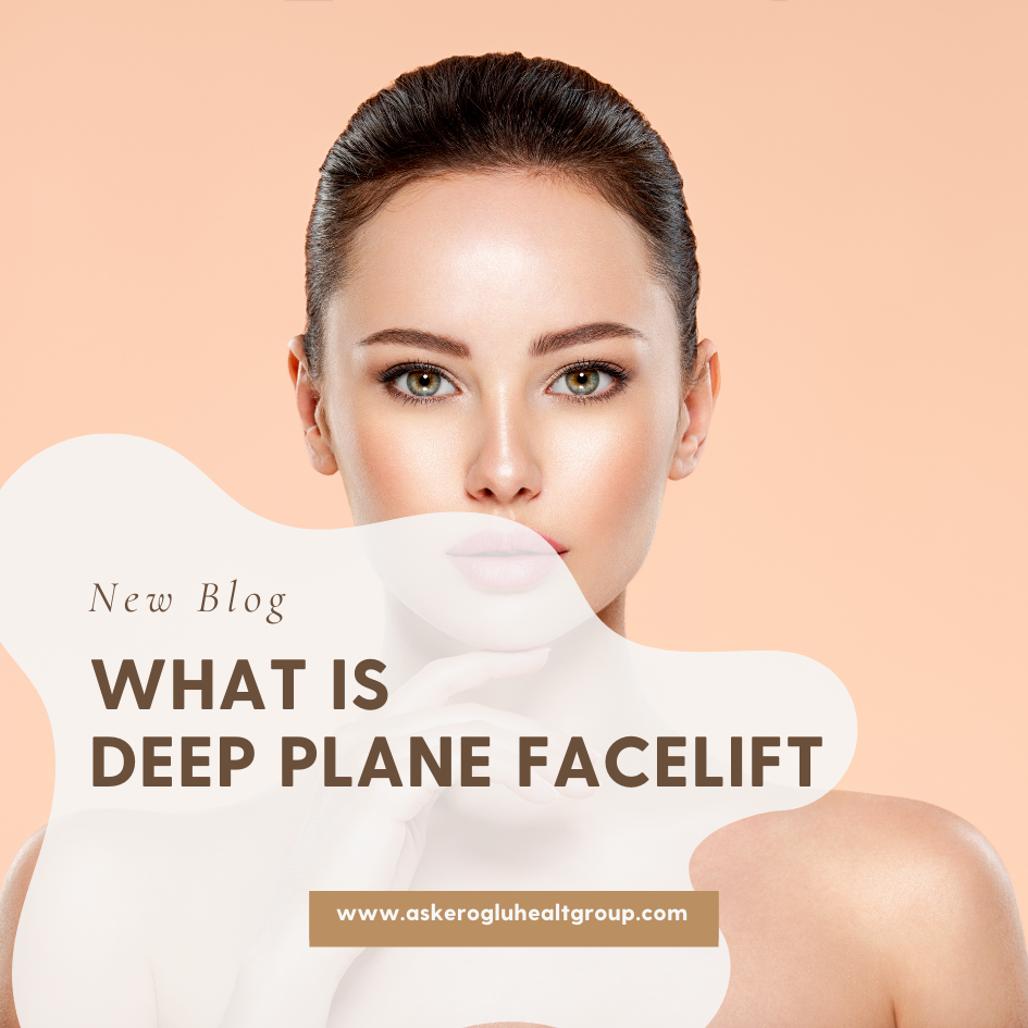 What Is Deep Plane Facelift