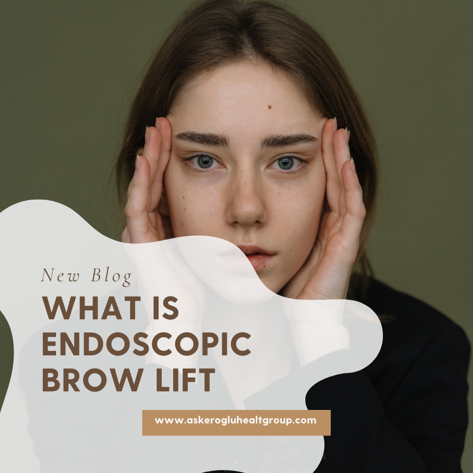 What Is Endoscopic Brow Lift