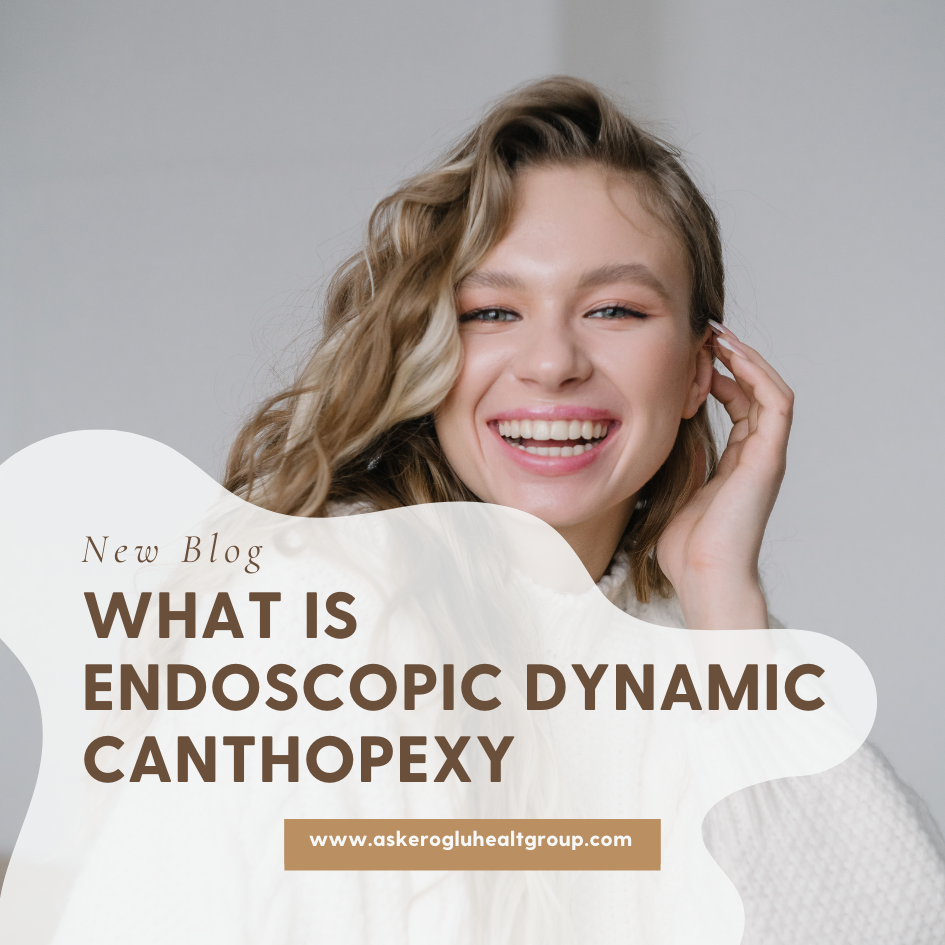 What Is Endoscopic Dynamic Canthopexy