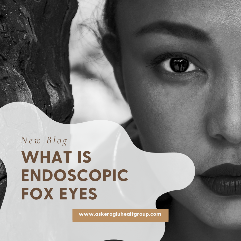 What Is Endoscopic Fox Eyes