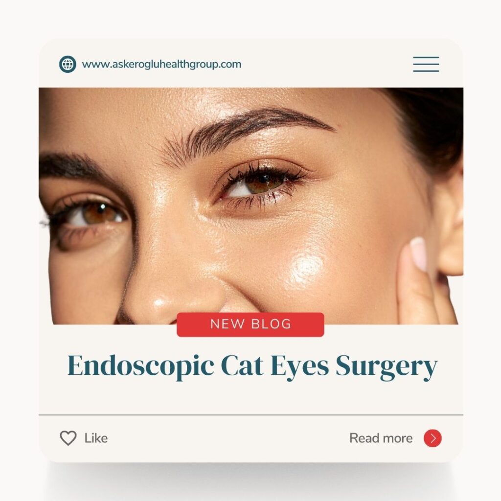 Endoscopic Cat Eye Surgery Turkey
