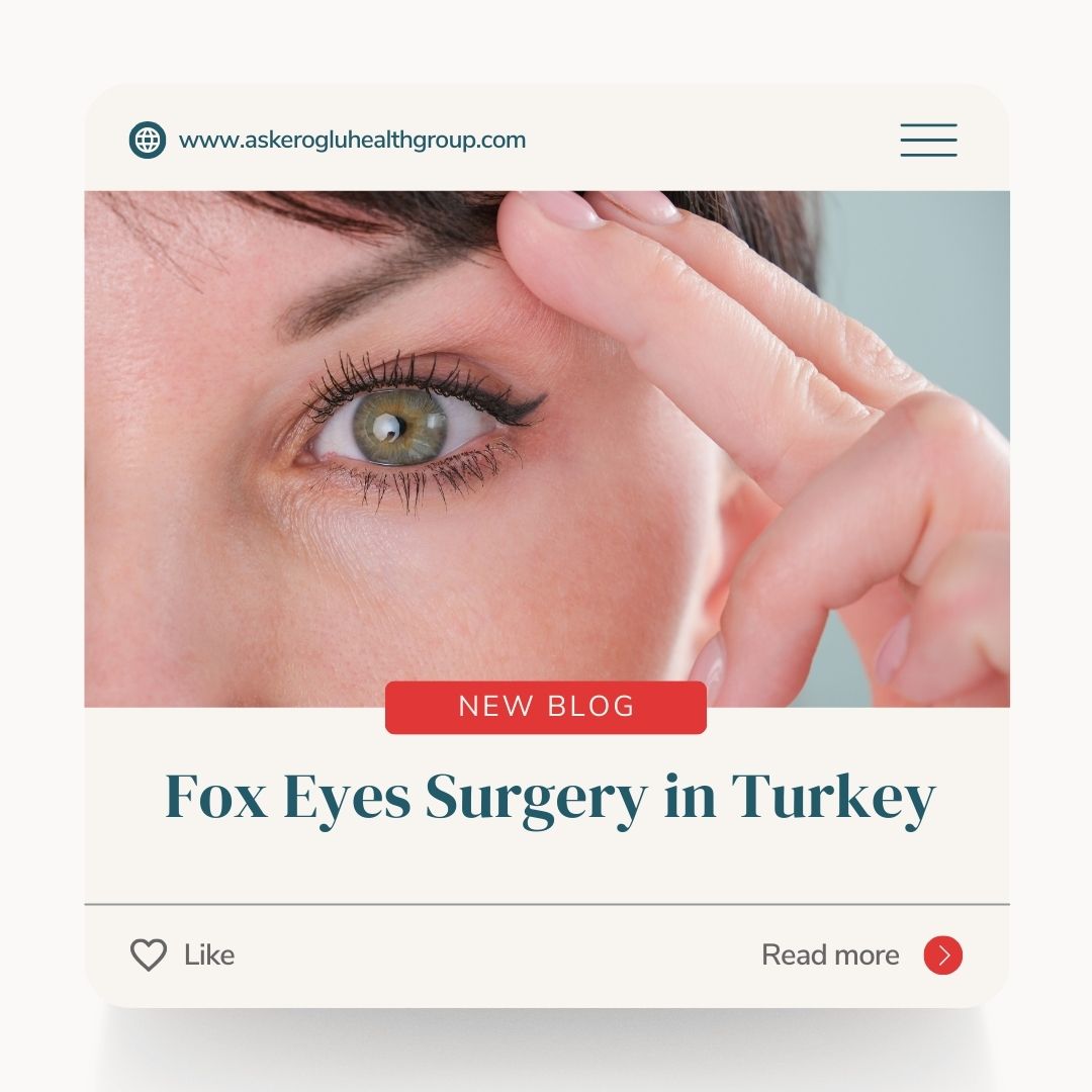 Fox Eyes Surgery in Turkey