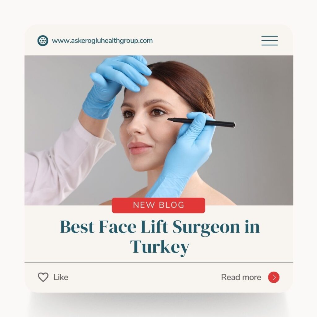 Best Facelift Surgeon in Turkey