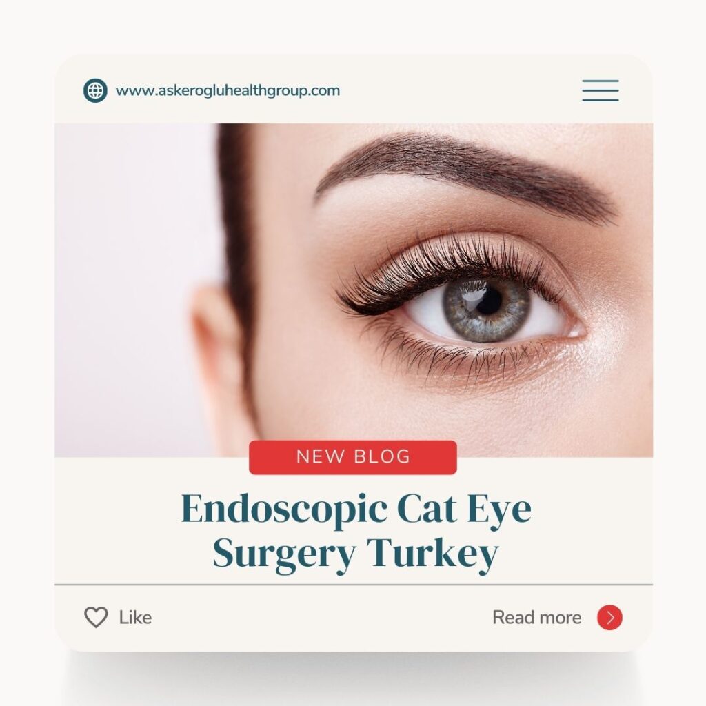 Endoscopic Cat Eye Surgery Turkey