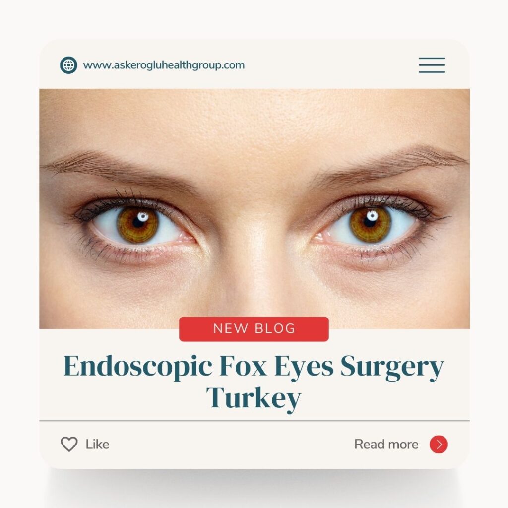 Endoscopic Fox Eyes Surgery Turkey
