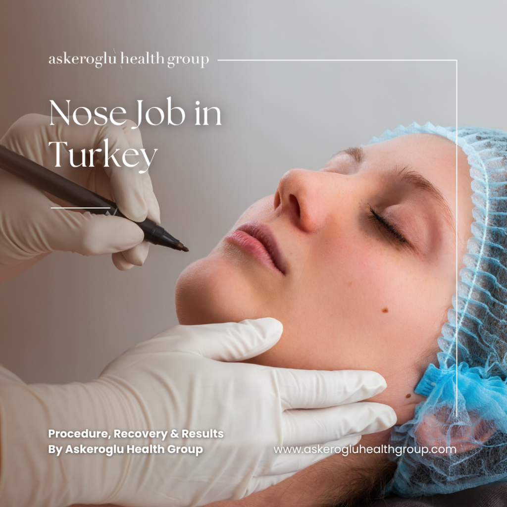 Cheap Nose Job Turkey