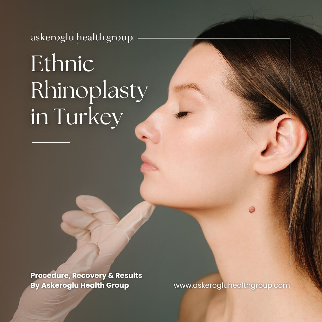 Ethnic Rhinoplasty Turkey