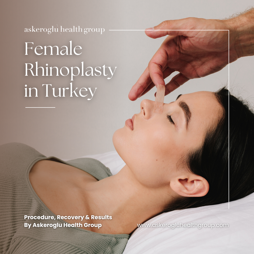 Female Rhinoplasty in Turkey