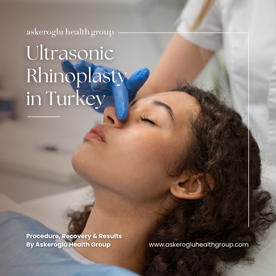 Ultrasonic Rhinoplasty in Turkey