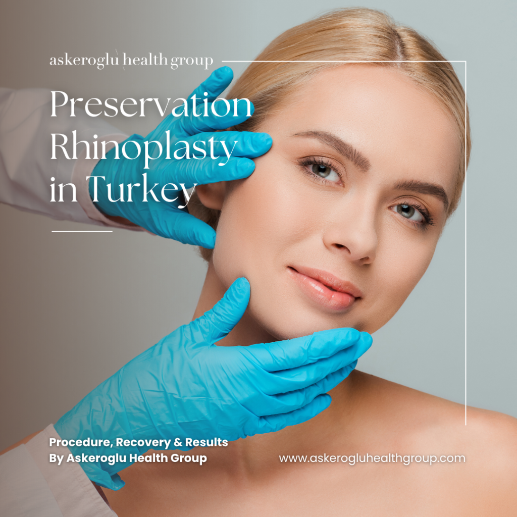 Preservation Rhinoplasty in Turkey
