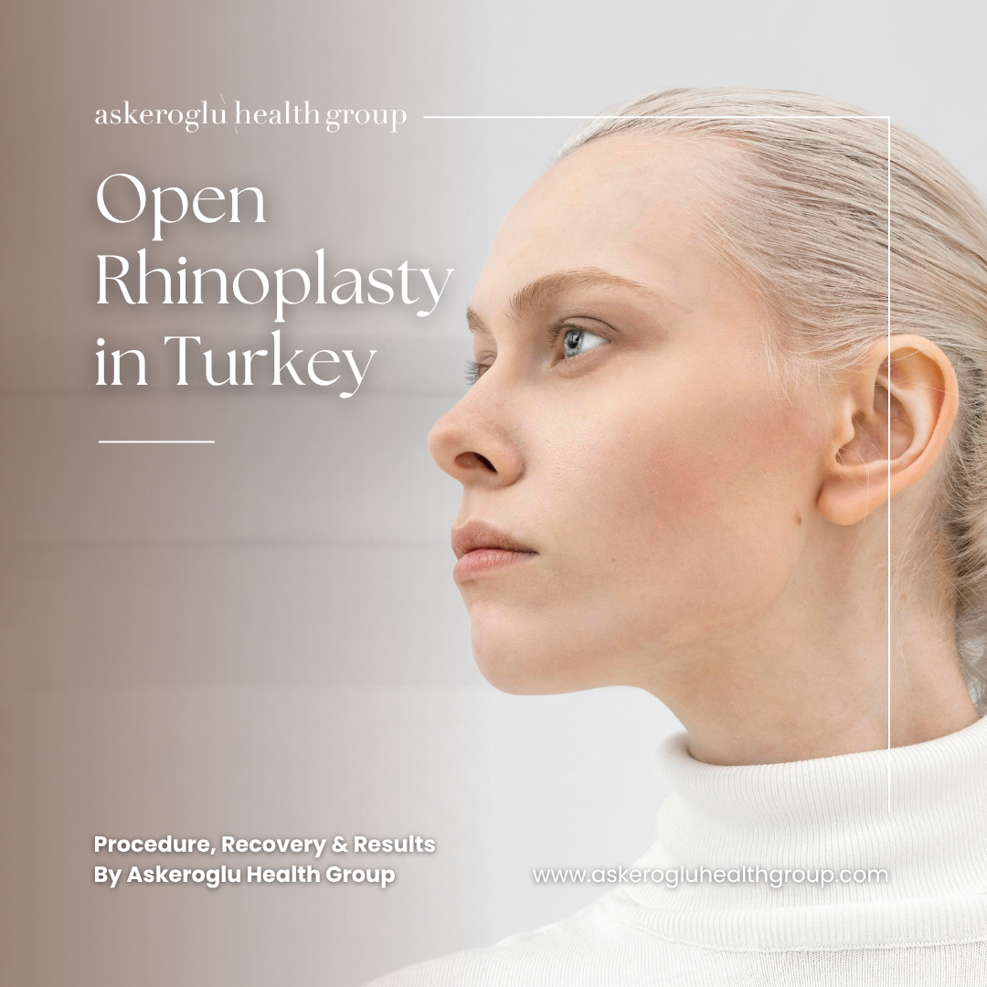 Open Rhinoplasty in Turkey
