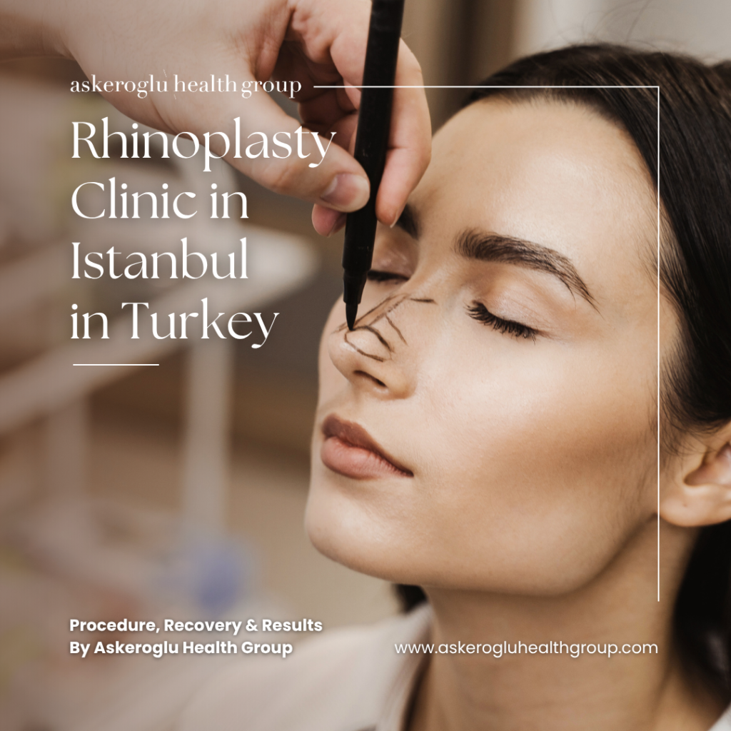 Rhinoplasty Istanbul